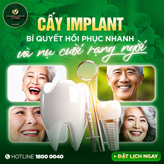 GIÁ CẤY IMPLANT: LỰA CHỌN CHẤT LƯỢNG VỚI CHI PHÍ HỢP LÝ