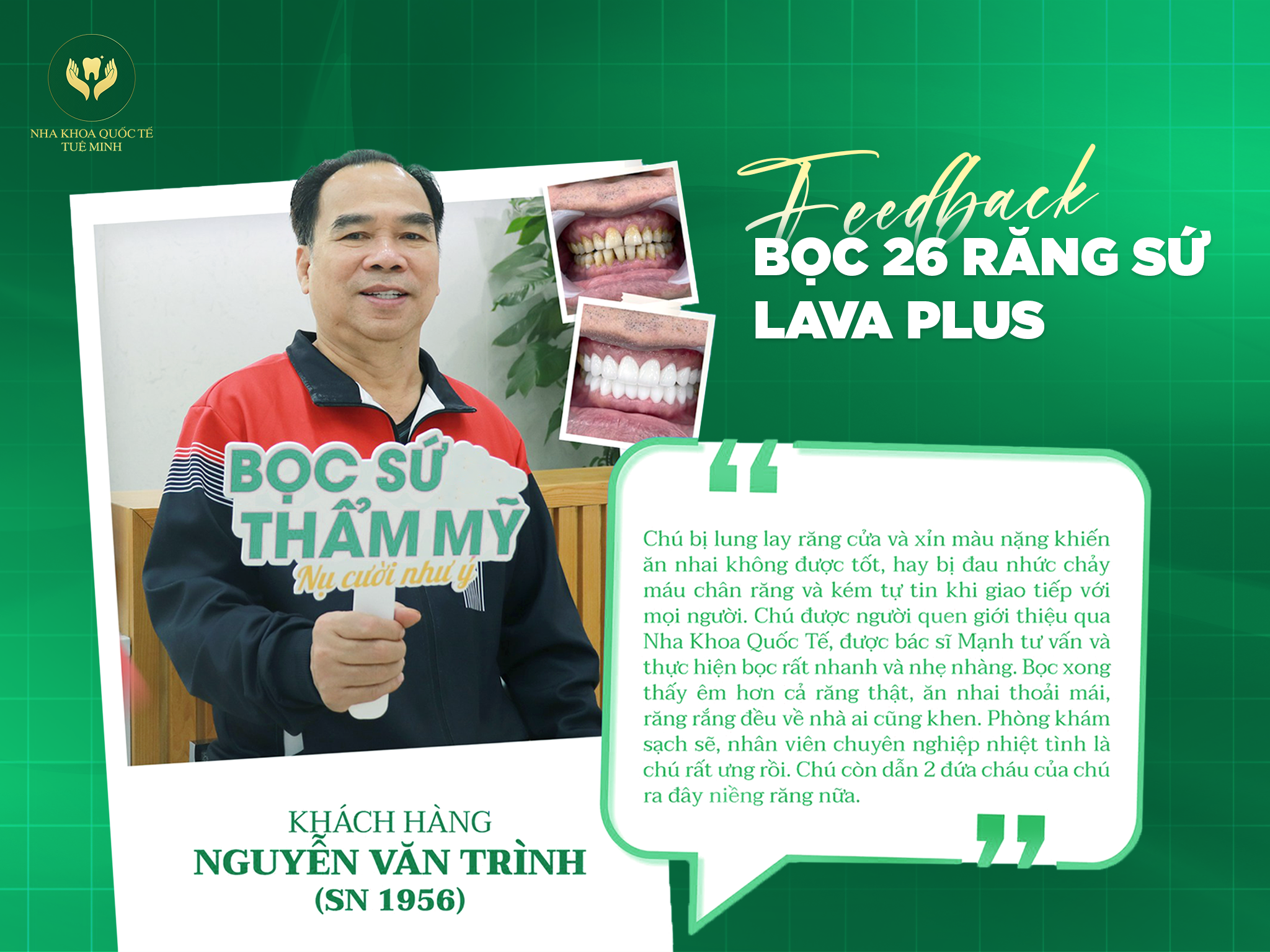 Feedback BỌC 26 RĂNG SỨ LAVA PLUS