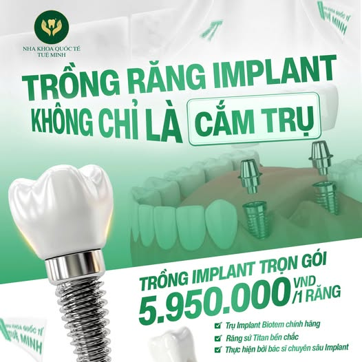 TRỒNG IMPLANT KHÔNG CHỈ LÀ “CẮM TRỤ”! HIỂU ĐÚNG ĐỂ LÀM ĐÚNG NGAY TỪ ĐẦU